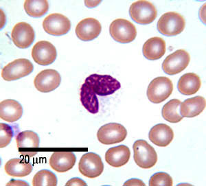 photo of a monocyte