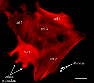photo of actin in cell