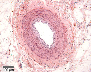 photo of arteriole