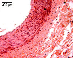 photo of muscular artery