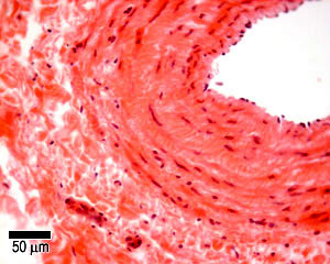 photo of muscular vein