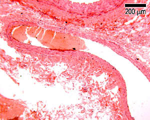 photo of a vein
