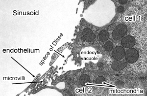 EM of discontinuous capillary
