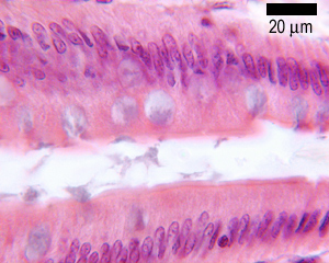 photo of epithelium small intestine