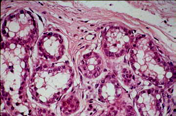 magnified image of a mammary gland during pregnancy