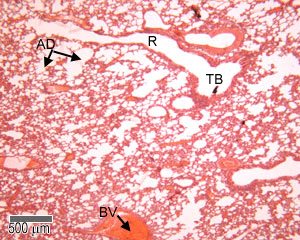 terminal bronchioles and alveoli photo