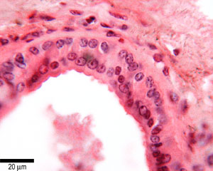 photo of epithelium