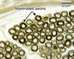 photo of myelinated axons