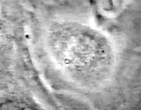 Drawing of a cell in prophase