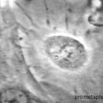 Drawing of a cell in prometaphase