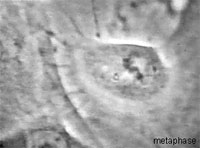 Drawing of a cell in metaphase