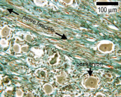 Massons trichrome staining