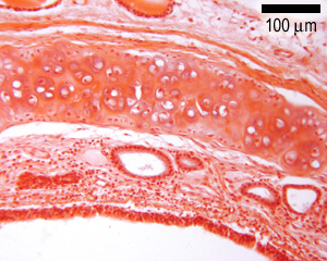Cross section through the trachea