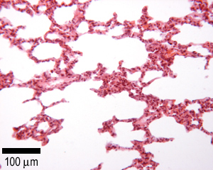 Cross section through the lung