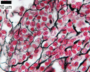 Reticular fibres