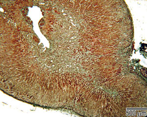 Adrenal gland
