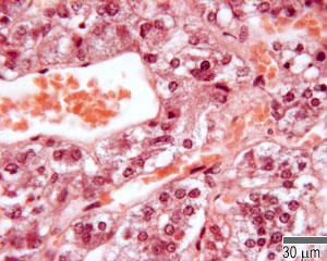 Adrenal medulla
