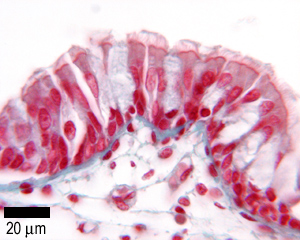 Section from the trachea