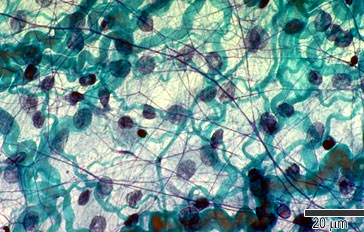 Loose connective tissue from a lymph gland