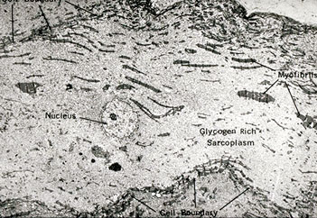 EM of purkinje cell