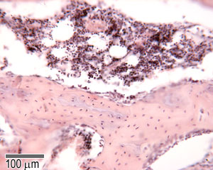 Section through a marrow space within a bone