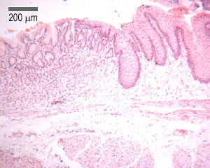 Oesophageo-gastric junction