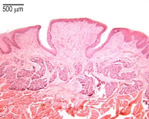 Vertical section of tongue