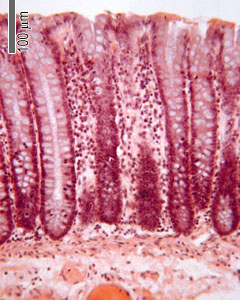 Mucosal layer