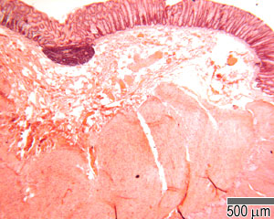 Low power image of the colon