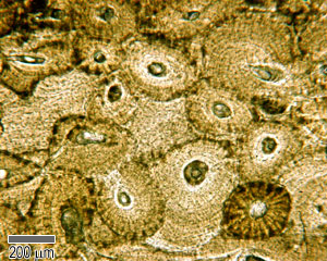 Cross section through bone.