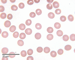 Giemsa staining phot