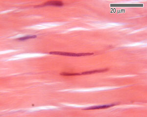 Dense regular connective tissue