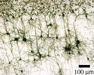 Cerebral cortex