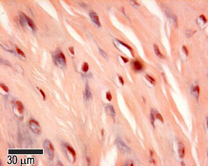 Section of an invertebral disc