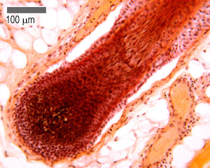 Magnified image of the hair bulb