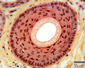 Cross section through part of a hair follicle