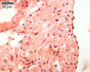 Endocardium