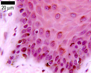 Melanocytes