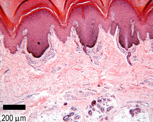 H&E section of thick skin