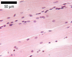 Skeletal muscle