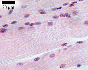 H&E stained muscle section