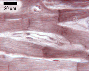 Cardiac muscle cells