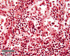 A post-capillary venule