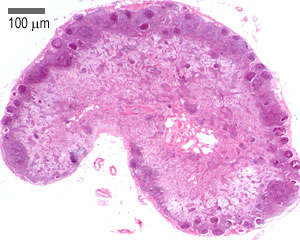 H&E stained section of a lymph node