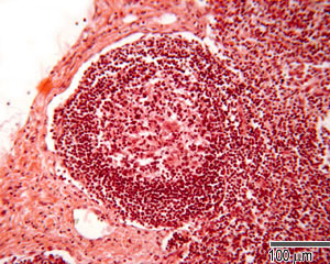 Lymphoid follicle