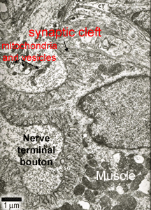 EM of synapse