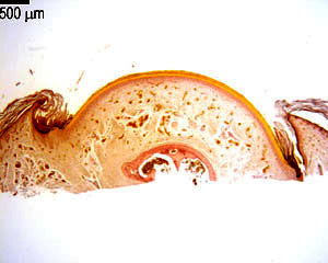 Transverse section through a nail