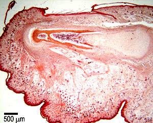 H&E section through a finger