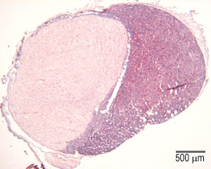 Pituitary gland