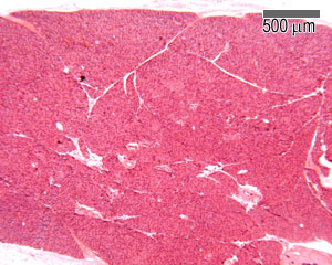 Section of pancreas